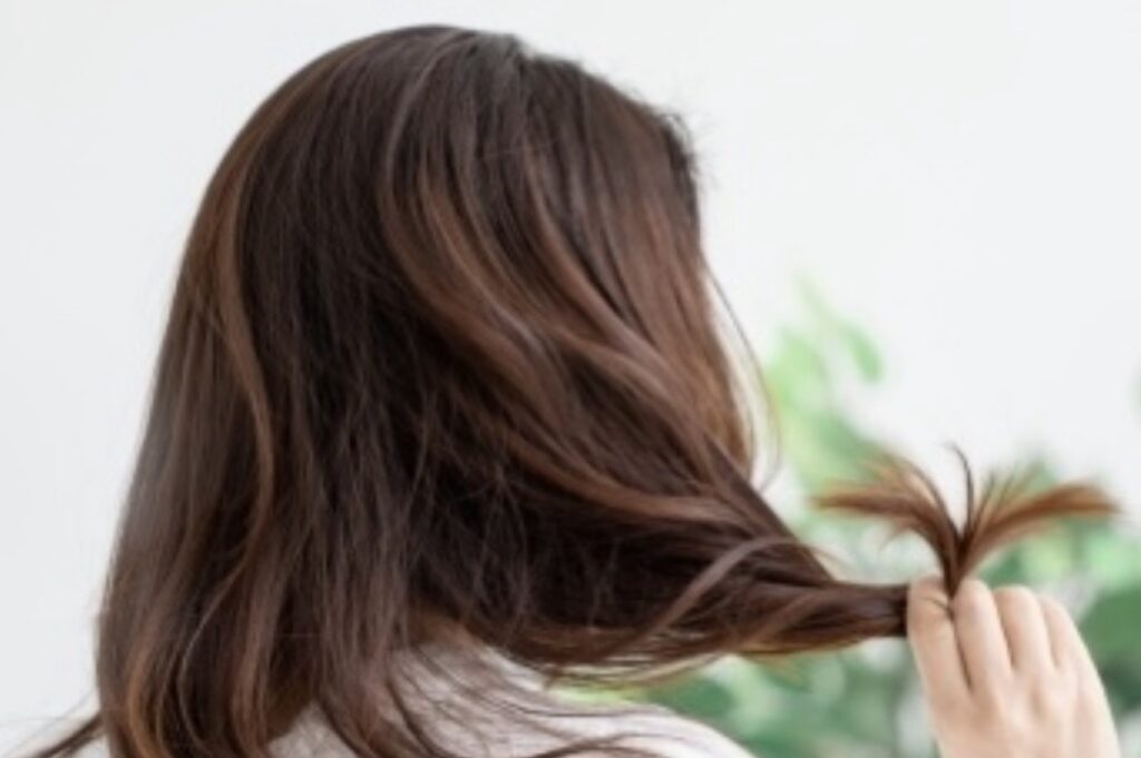 びまん性脱毛症